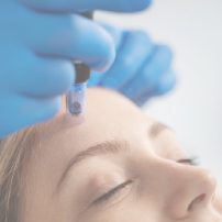 Microneedling
