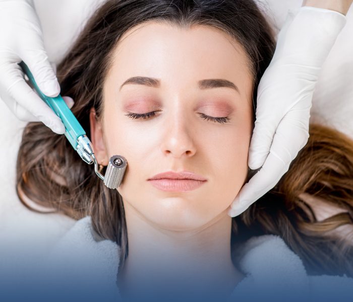 Microneedling en Puerto Vallarta