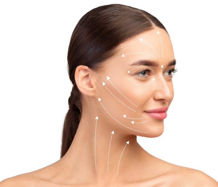Armonización facial