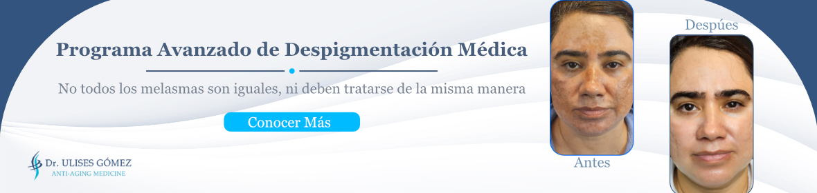 Banner promocional